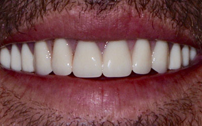 After
