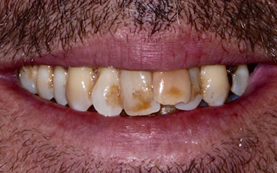 Before